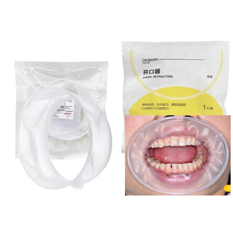 Teeth Whitening Clinic - 20Pcs Dentpark O-Shape Oral Cheek Retractor