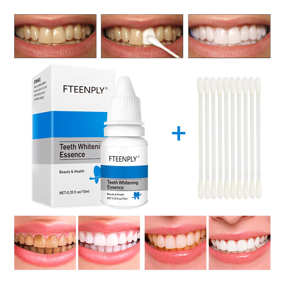 FTEENPLY Teeth Whitening Essen - Teeth Whitening Clinic review and price