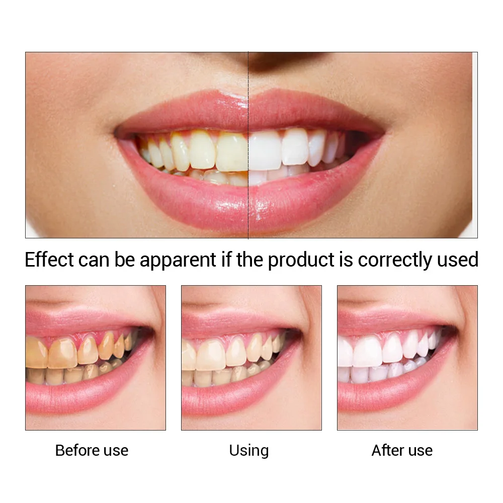 FTEENPLY Teeth Whitening Essen - Teeth Whitening Clinic review and price